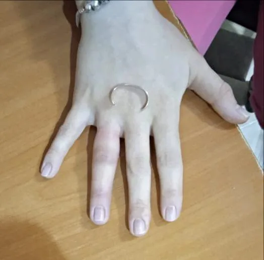 Спасатели Люберец помогли женщине снять кольцо с отекшего пальца