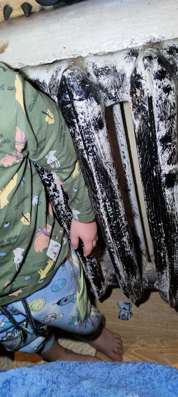 Спасатели помогли ребенку из поселка Люберец, у которого рука застряла в батарее