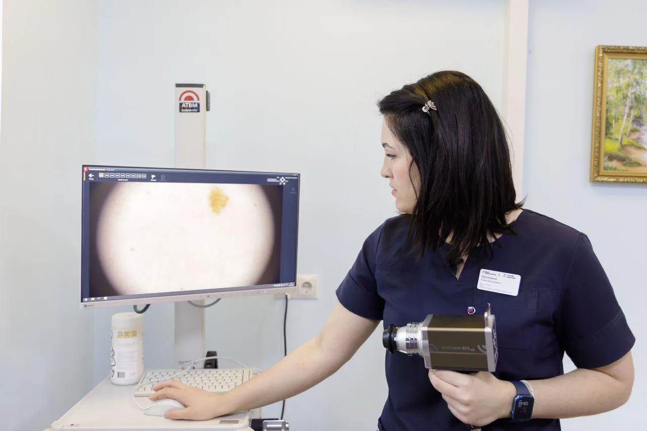 Сотрудники ЦАОП Люберец обследовали 24 пациента в День открытых дверей по диагностике меланомы