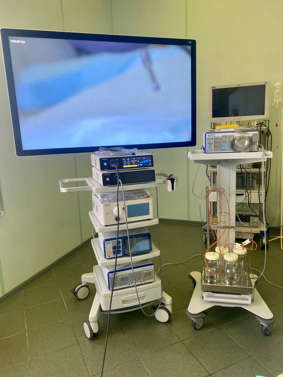 В родильный дом Люберец поступило новое медицинское оборудование